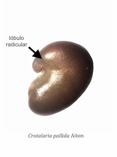 Lobulo radicular 2